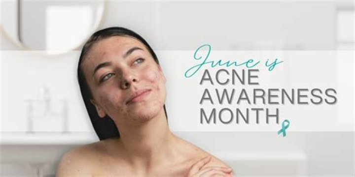 Acne Awareness Month: 7 Cleansers That Will Help Banish Zits & Clear Out Your Pores