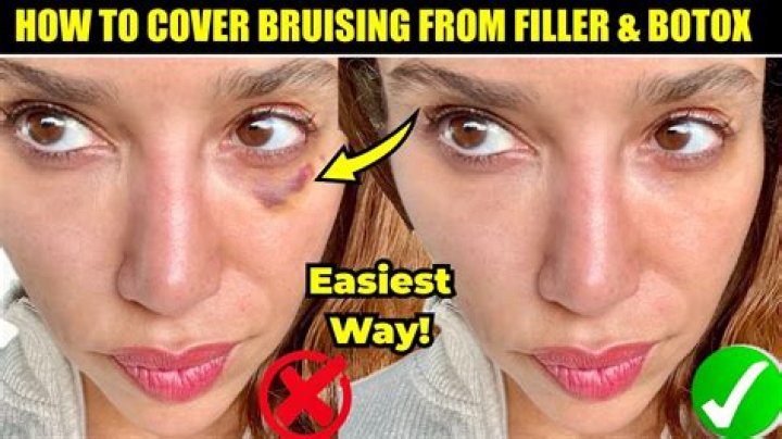 Amber Heard’s Makeup Artist Testifies That She Helped Her Cover Up Bruises