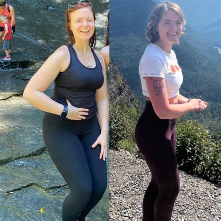 Amy Schumer Rocks A One-Piece Swimsuit & Reveals She Weighs 170 Lbs. After Lipo