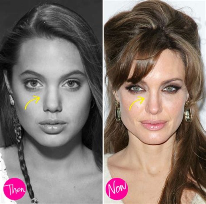 Angelina Jolie Claims She's Never Had Plastic Surgery — But Hey Sure Looks Like You Had A Nose Job! – Hollywood Life