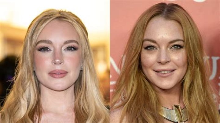 Before & After — Did She Get Plastic Surgery On Her Face? – Hollywood Life