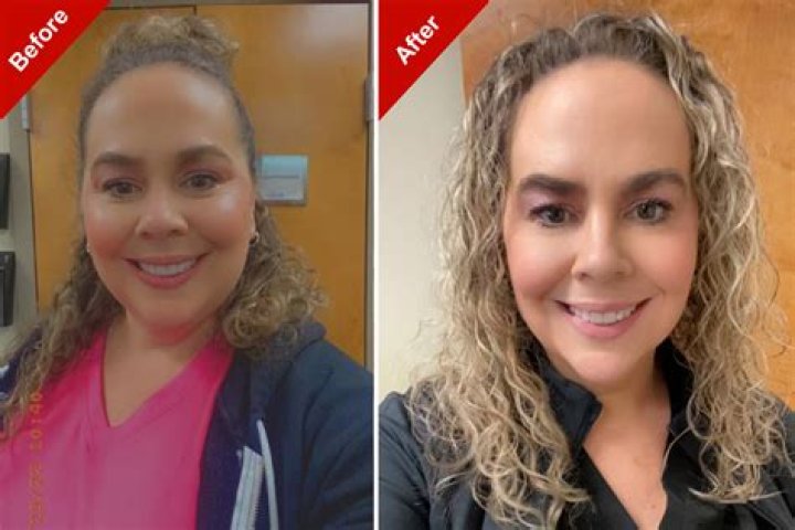 Before and After Photos – Hollywood Life