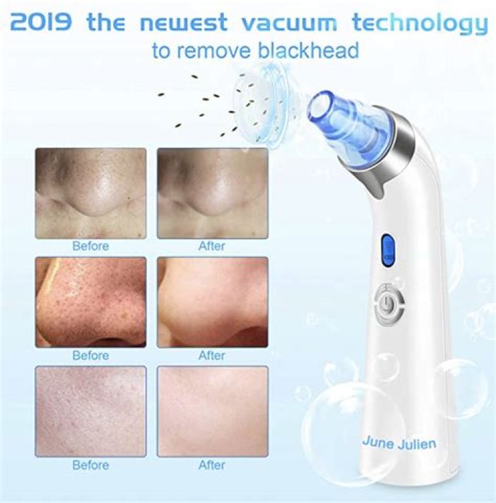 Best Blackhead Remover Vacuum & Pore Facial Cleanser: Shop – Hollywood Life