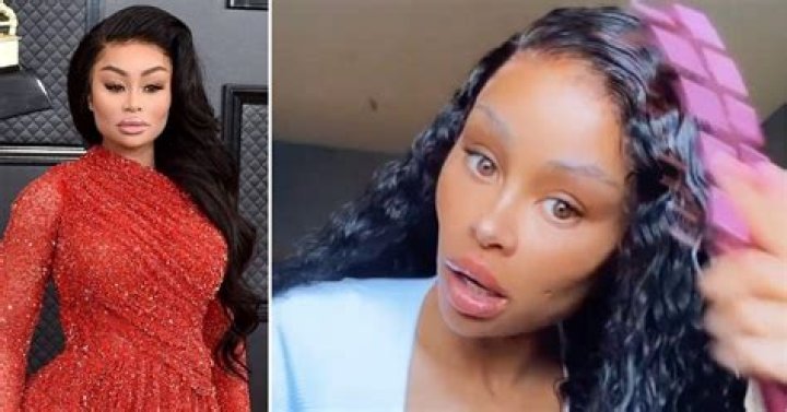 Blac Chyna Goes Makeup-Free After 2nd Round Of Dissolving Fillers – Hollywood Life