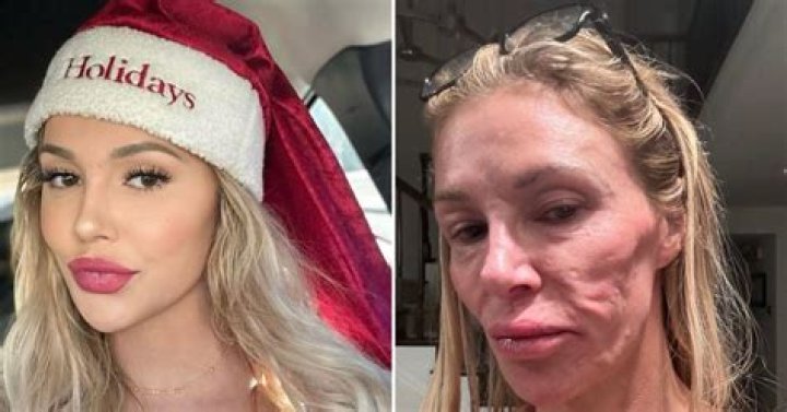 Brandi Glanville Called ‘Thirsty’ After Fans Think She Posted A Photo Of Her Kissing Denise Richards