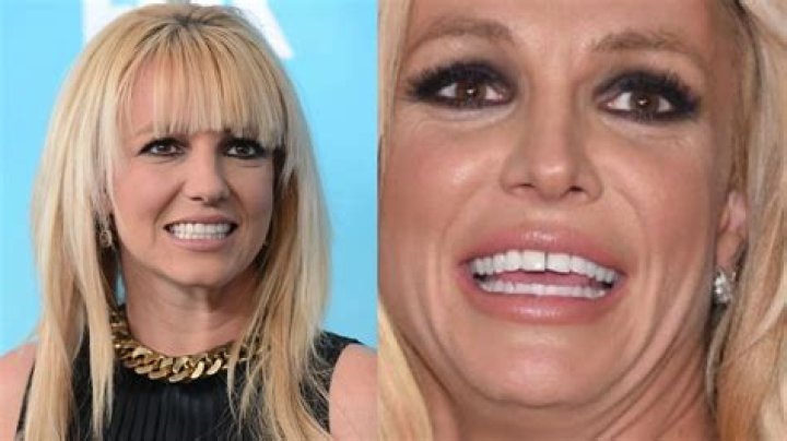 Britney Spears Going To A Wellness Treatment Facility — What It Is Explained