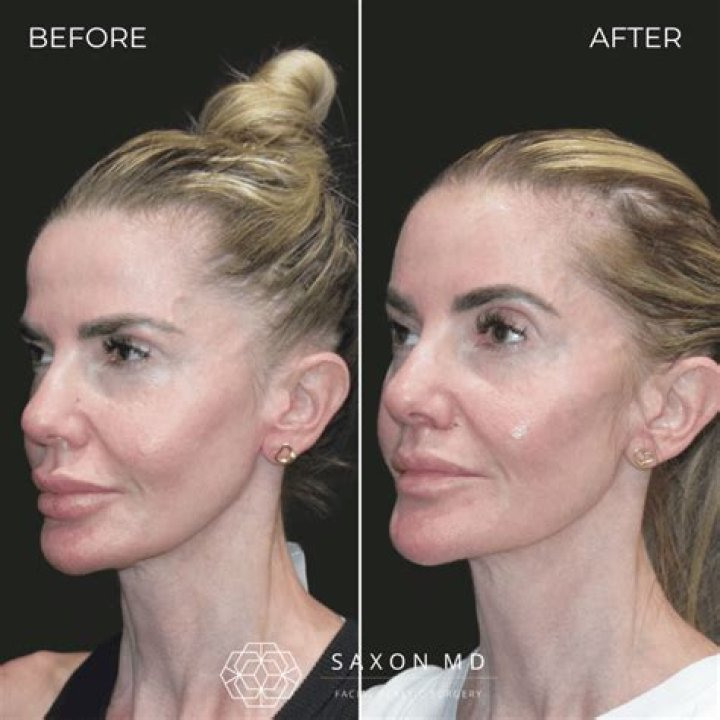 Britney, You Were So Close! Her Big Brow Oops And How YOU Can Avoid It!