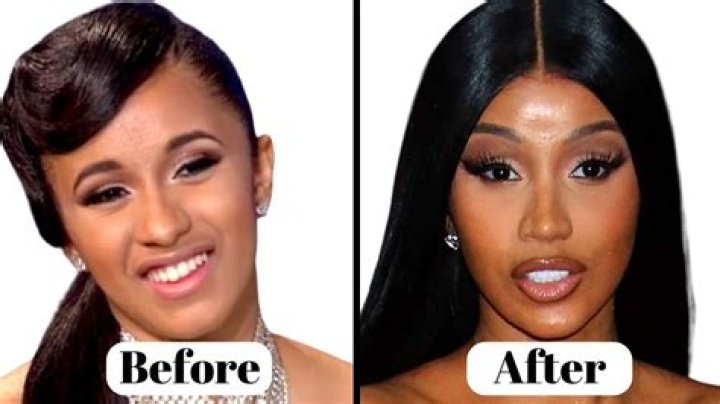 Cardi B Talks Liposuction & Plastic Surgery On IG & Shows Off Abs: Pic – Hollywood Life