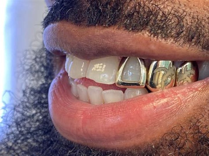 Chris Brown Flexes Wearing 24kt Gold Grills Worth Nearly $100K — See Photo