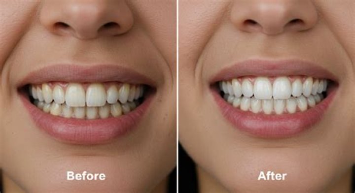 Chrishell Stause Shared the Whitening Strips She Uses for the Perfect Smile