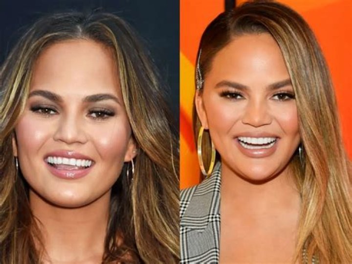 Chrissy Teigen Claps Back After Troll Accuses Her Of Having ‘Balding Hair’: ‘People Just Suck’