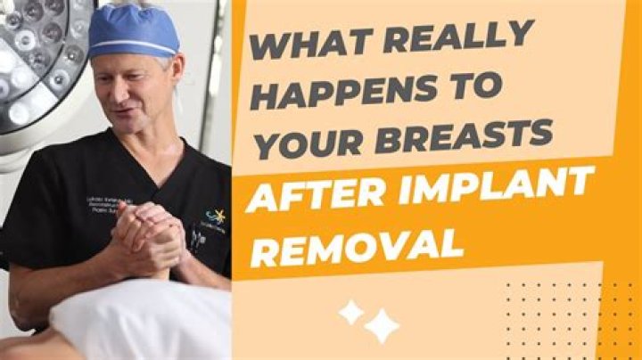Clare Crawley Shares 1st Photo After Having Her Breast Implants Removed: ‘I Did It’