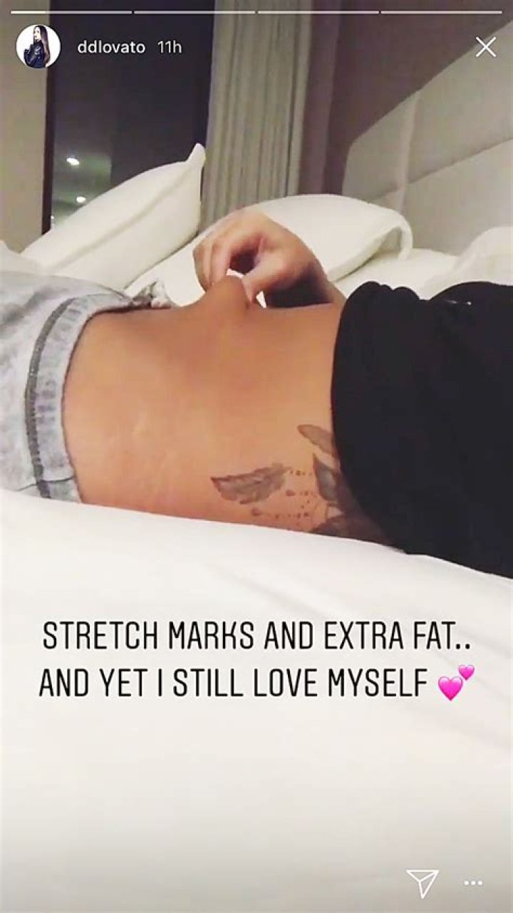 Demi Lovato Reveals Stretch Marks In Photo After Showing Off Cellulite — See Body-Positive Pic