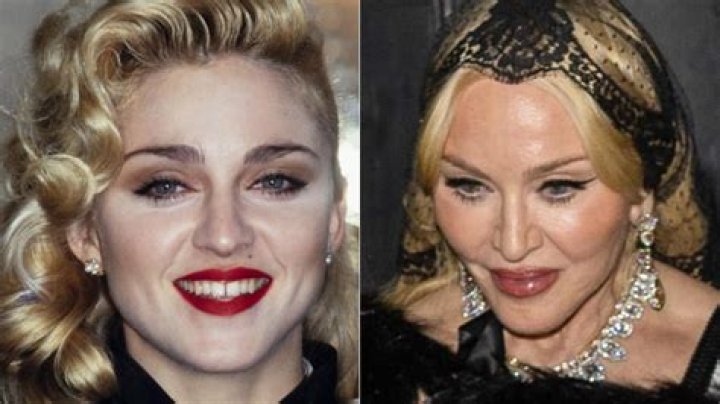 Did Madonna Get Butt Implants? — Before & After Pics – Hollywood Life