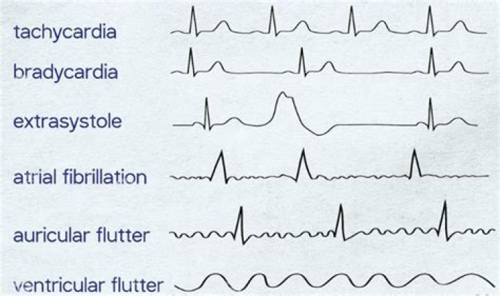 Died Of Cardiac Arrhythmia – Hollywood Life