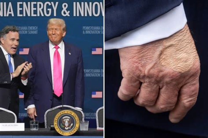 Donald Trump Gets Mocked As Photo Showing His ‘Bad’ Tan Lines Goes Viral- ‘Is This Real?’