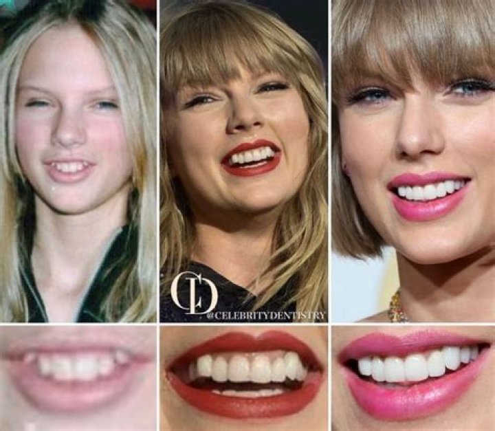 Flashes Smile After Taylor Swift’s ‘Gorgeous’ – Hollywood Life