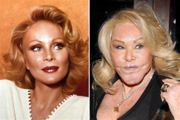 Getting 37th Plastic Surgery To Look Fake – Hollywood Life