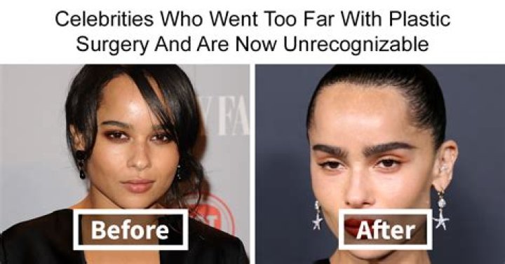 Got Plastic Surgery? – Hollywood Life
