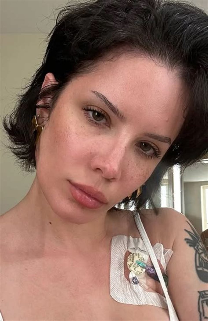 Halsey Reveals Multiple Diagnoses After Several Hospitalizations: I’m ‘Allergic To Everything’