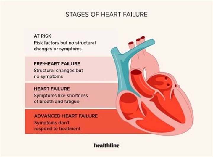 Heart Failure Behind His Death? Expert Explains What Causes It – Hollywood Life