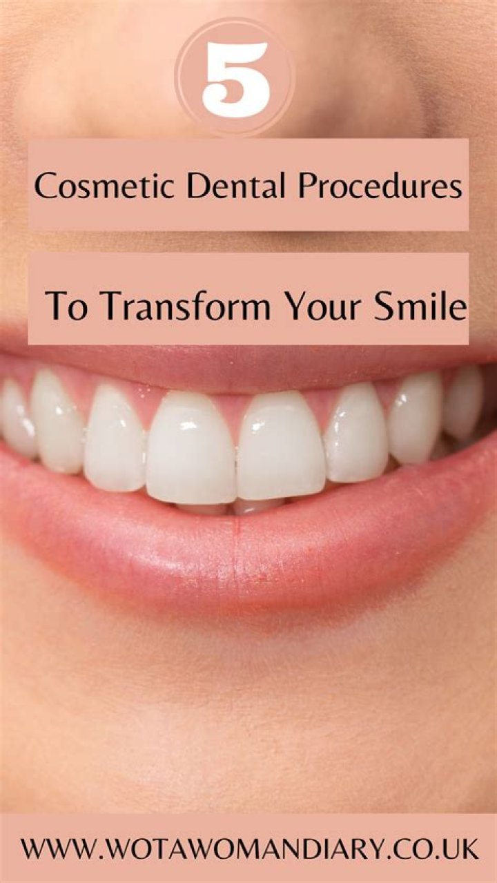 Hollywood’s Perfect Smile: A Guide to Cosmetic Dental Procedures