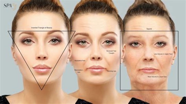 How Celebrities Look Beautiful On Red Carpets: The Injections, Fillers & Facials They Get — Surgeons Speak