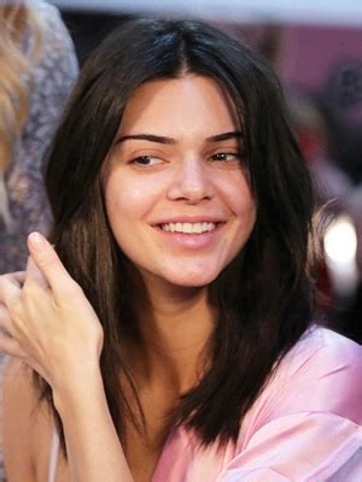 How To Deal With Stress Acne Like Kendall Jenner: Dermatologist Reveals How To Make It Better