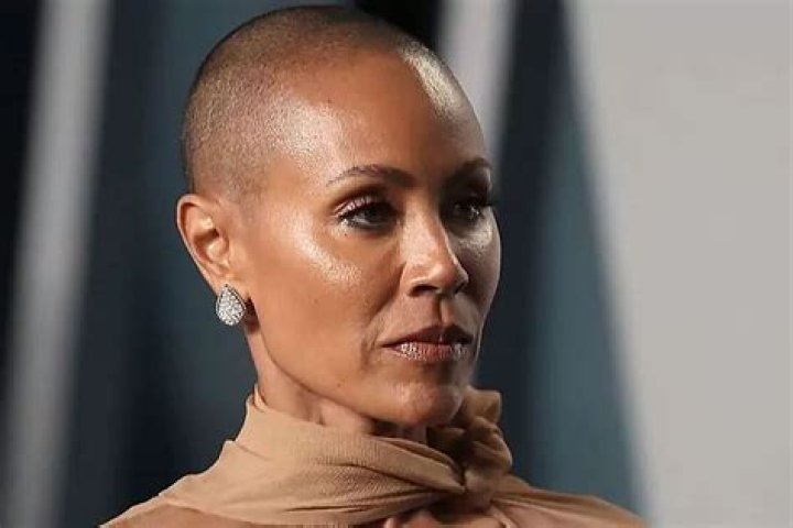 Jada Pinkett-Smith Shows Off Hair Loss Line Due To Alopecia: ‘I Can Only Laugh’ — Watch