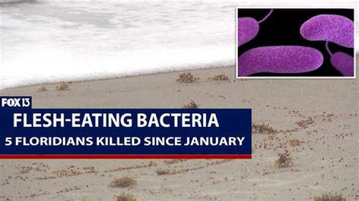 Jamie Sangouthai’s Cause Of Death: Flesh-Eating Disease Explained — Expert Says