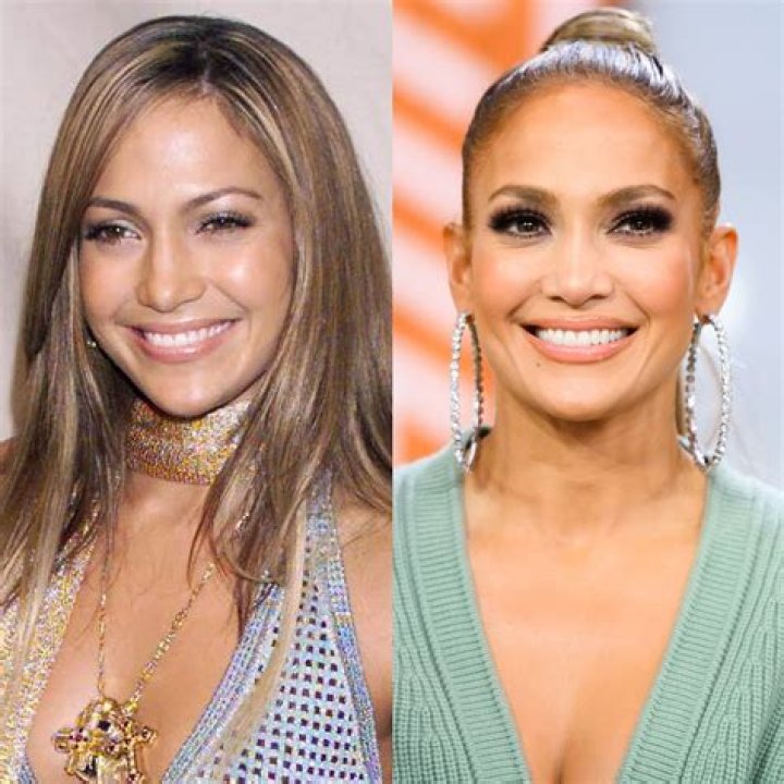 Jennifer Lopez Claps Back At Troll Who Insists She’s Had Botox: My ‘Beauty Secret’ Is Loving My Own Skin
