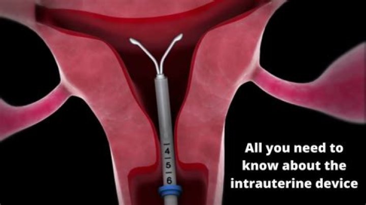 Jessica Simpson Has An IUD For Birth Control– Why Mine Was The Best Decision Ever