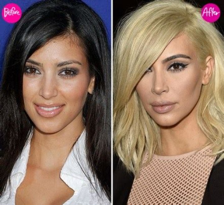 Kardashian Lip Looks Before & After – Hollywood Life