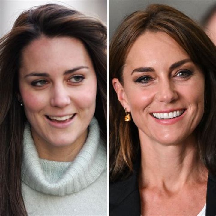 Kate Middleton’s First Appearance After Birth — Pics