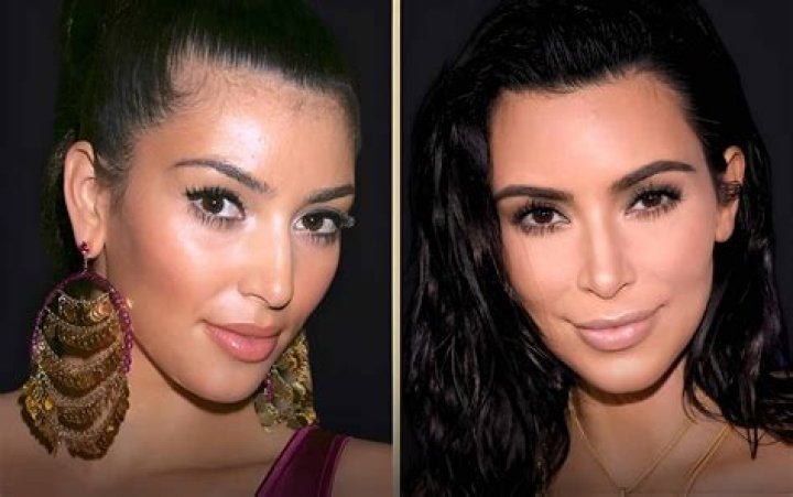 Kim Kardashian: Botox Overload Or Stunning?
