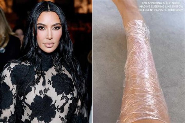 Kim Kardashian Diagnosed With Psoriasis
