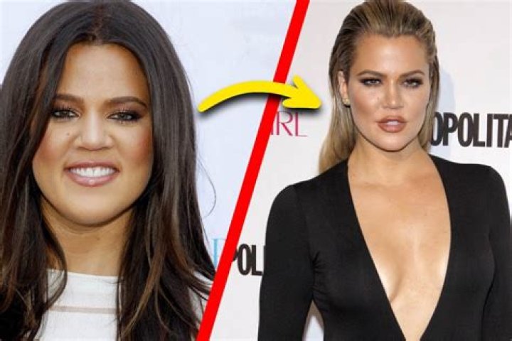 Kim Kardashian & More: 8 Biggest Weight Loss Successes