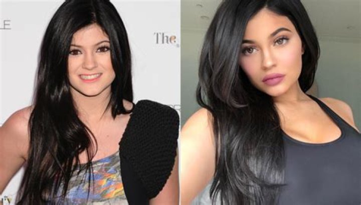 Kylie Jenner’s Face Through The Years — Lips & Makeup Changes – Hollywood Life