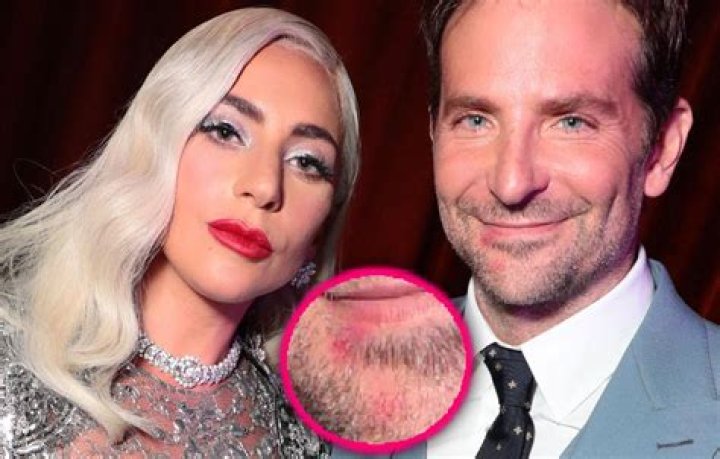 Lady Gaga Fans Freak After Her Lipstick Shade Appears On Bradley Cooper’s Chin Amid Romance Denial