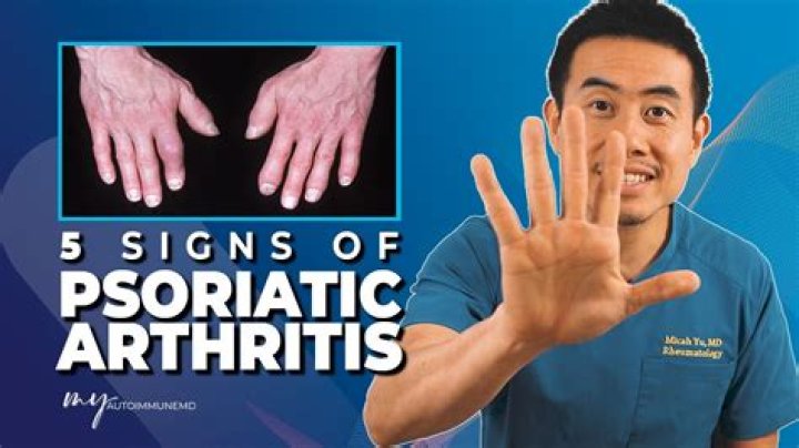 Lance Bass Explains Why It Was ‘Very Important’ To Go Public With His Psoriatic Arthritis