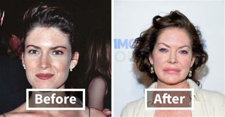 Linda Evangelista, 57, Looks Gorgeous In 1st Modeling Job After Plastic Surgery Left Her ‘Disfigured’