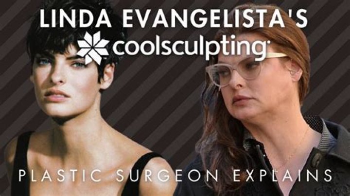 Linda Evangelista Admits She Still Gets Botox After Being ‘Brutally Disfigured’ By CoolSculpting Procedure