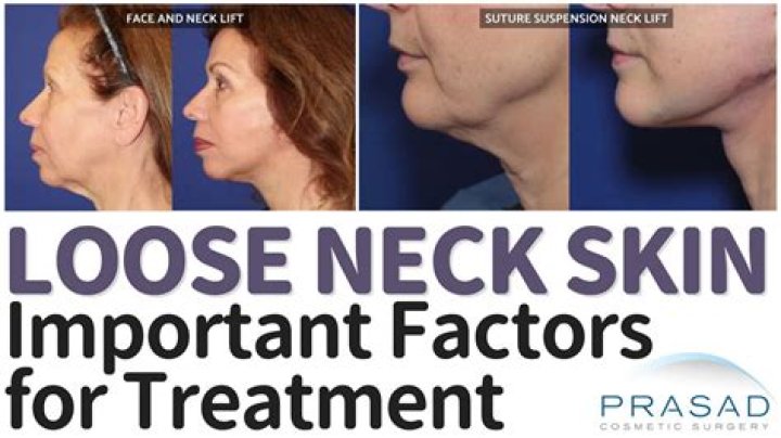 Loose Neck Skin? The New No Laser Way To Get Rid Of ‘Tech Neck’