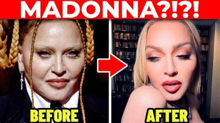 Madonna Shows Scar From Hip Surgery While Wearing Black Bikini — Pic – Hollywood Life