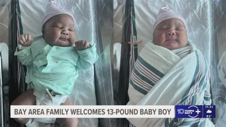 Mom Has Painful Ovaries Removed, Doctors Find 9lb Baby Inside