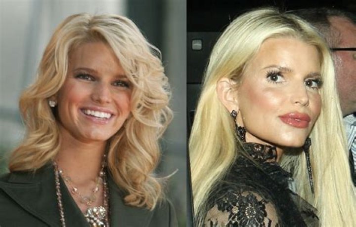 Non Surgical Facelift Jessica Simpson Tried – Hollywood Life