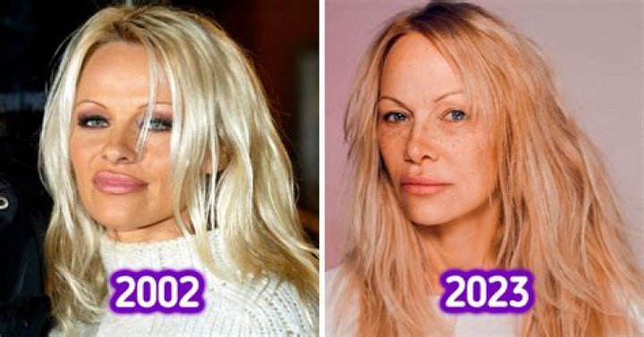 Pamela Anderson Face Timeline — PICS
