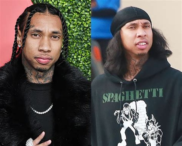 Photo Of Rapper Without Braids — Before & After Pic – Hollywood Life