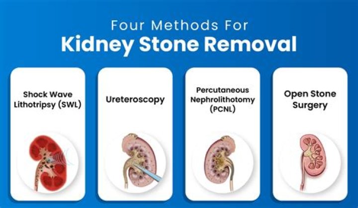 Photos Of Kidney Surgery – Hollywood Life