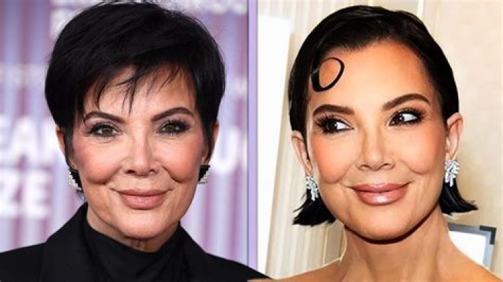 [PICS] Kylie Jenner’s Plastic Surgery — Has The 17-Year-Old Gone Too Far? – Hollywood Life